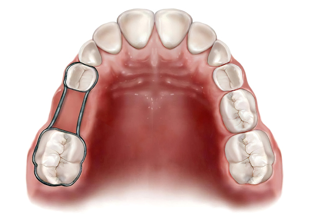 Orthodontics